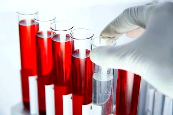 Клинический анализ крови может обнаружить наличие воспалительного процесса