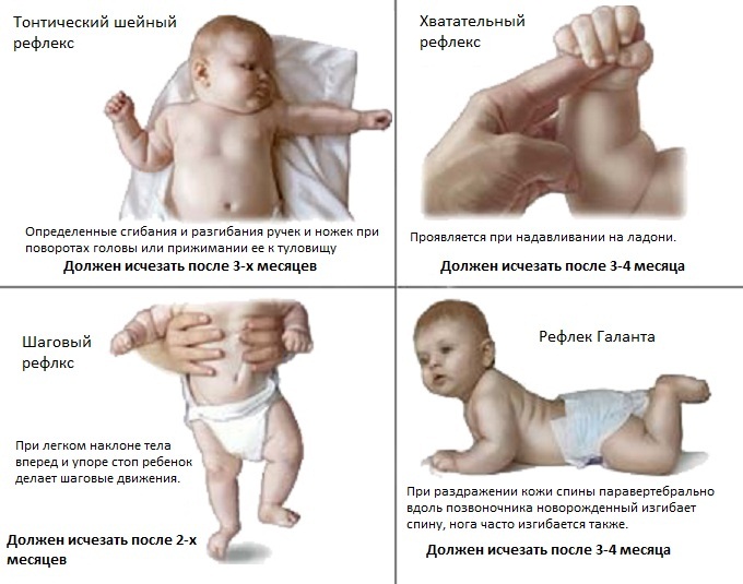 Нейросонография головного мозга у новорожденных. Нормы, таблица, когда делается, расшифровка результатов