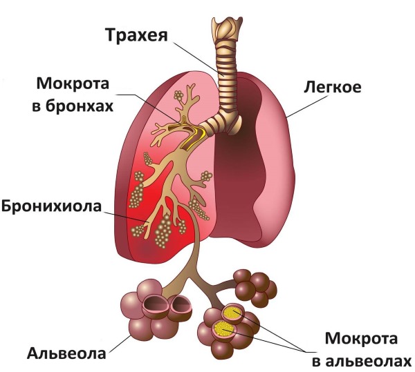 Аллергический кашель. Симптомы и лечение у взрослых. Как и чем лечить сухой, влажный, приступы у детей. Препараты, народные средства