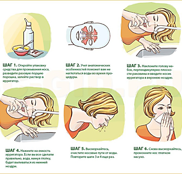 Промывка носа солевым раствором. Рецепт, как делать шприцом