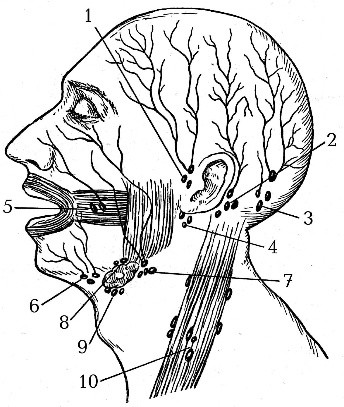 На шее лимфоузлы где расположены у человека. Поднижнечелюстные лимфоузлы узлы. Околоушные лимфатические узлы схема. Лимфоузлы околоушной области анатомия. Лимфатическая система нижней челюсти.