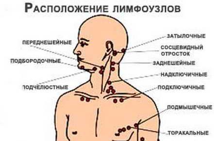 Лимфоузлы под челюстью схема как лечить