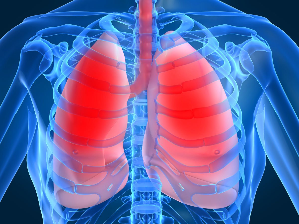 Возможные осложнения при туберкулезе лимфоузлов 