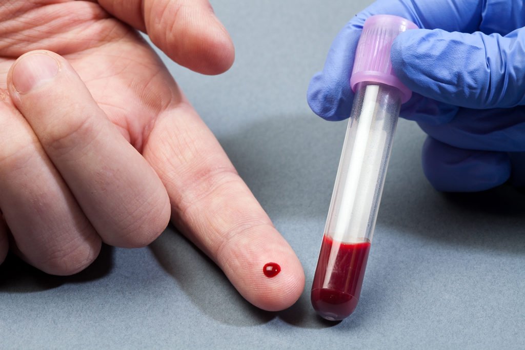 Повышение лимфоцитов в крови у мужчин