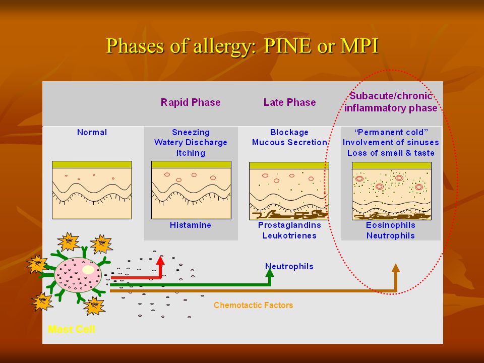 Phases of allergy: PINE or MPI