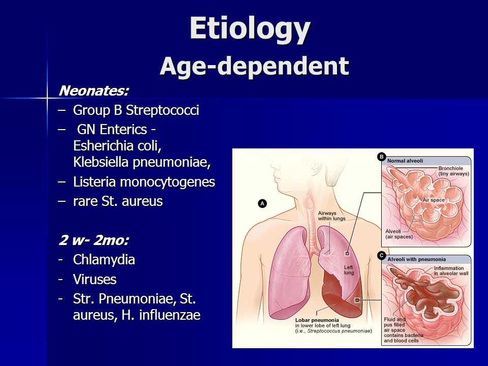 Etiology Age-dependent